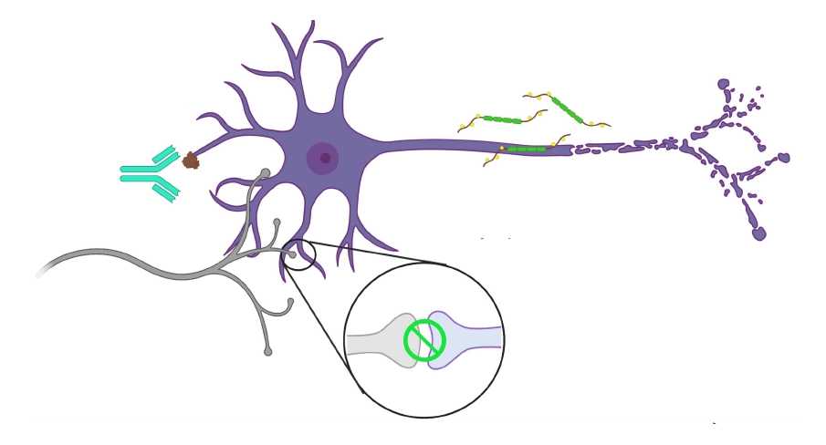 neurons_2webp